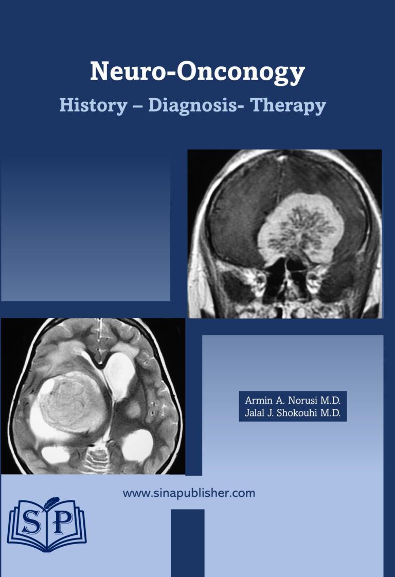NeuroOncology History, Diagnostic, Therapy Sinapublisher
